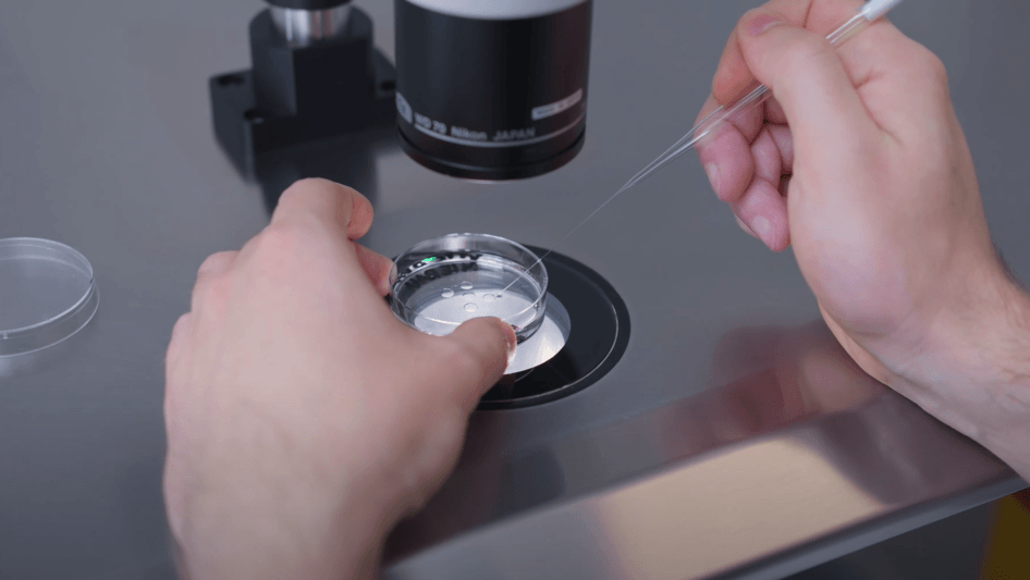Consulting for fertility treatment